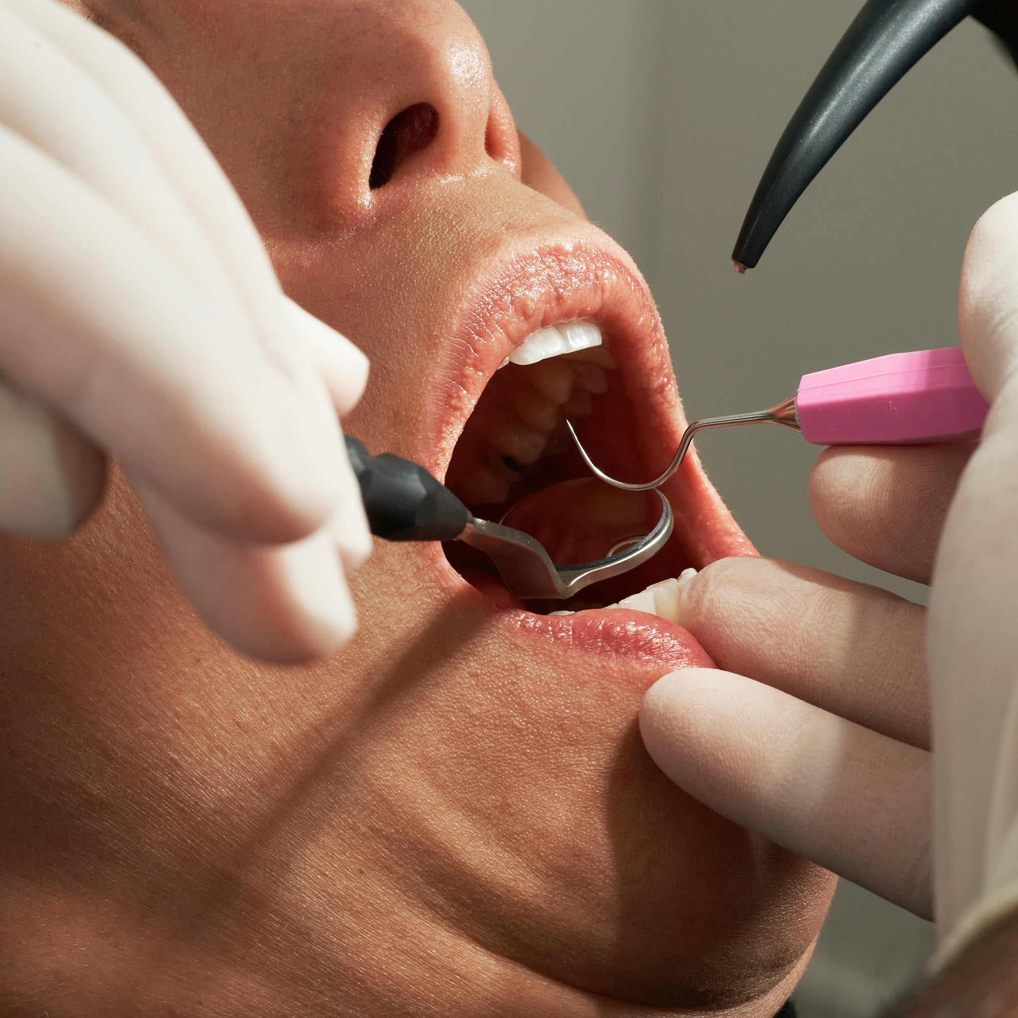 Dental Care